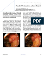 Acitrom Induced Pseudo-Obstruction A Case Report