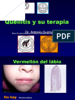 244 Queilitis Antonio Guzman