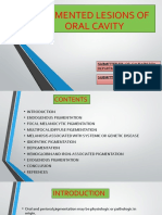 Pigmented Lesion of Oral Cavity