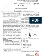 Detection of Various Diseases Using ECG Signal in Malab: Shital L. Pingale, Nivedita Daimiwal