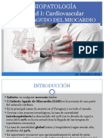 1.infarto Agudo Del Miocardio