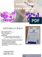 Hematología Leucemia Mieloide Aguda: Int. Khatherine Gavila Rojas Int. Gianella Peña Caso