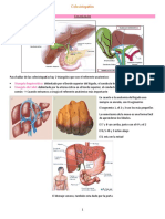 Colelitiasis