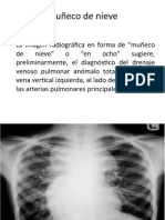 Signos Radiologicos