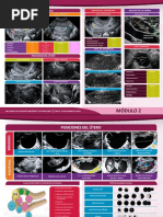 Ecografia Ginecologica
