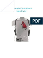 Dispositivo de Asistencia Ventricular