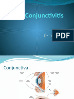 Conjunctivitis