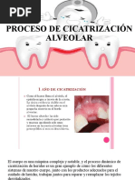 Cicatrización Alveolar