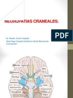 Neuropatias Craneales