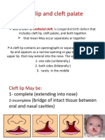 Cleft Lip and Cleft Palate