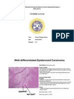 Tumor Ganas - B4 - 134 - Kresna Erlangga Setiawan