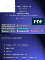 Caz Neoplasm Esofagian