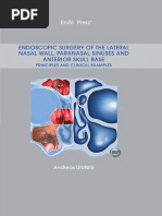 Endoscopic Surgery of The Lateral Nasal Wall, Paranasal Sinuses, and Anterior Skull Base (PDFDrive)