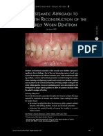 A Systematic Approach To Full-Mouth Reconstruction of The Severely Worn Dentition