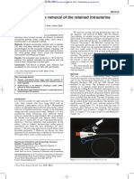 A Novel Device For Removal of The Retained Intrauterine Device