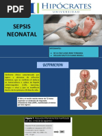 Sepsis Neonatal