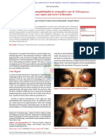 Acute Necrotizing Panophthalmitis in Seropositive Case of Chikungunya