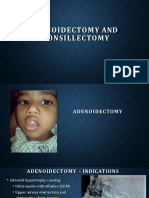 Adenoidectomy and Tonsillectomy 2