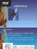 ARRTIMIAS