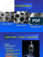 Osteoporosis