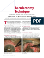 Trabeculectomy Technique