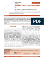 Breast Carcinoma in Axillary Tail of Spence: A Rare Case Report