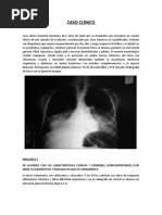 Caso Clinico de Neumonia