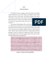 Atrial Fibrilasi