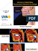 Válvula de Fala