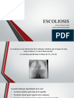 ESCOLIOSIS