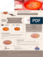 Retinopatía Diabética