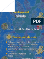 Patologia Oral - Ranula2