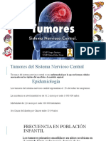 Tumores Cerebrales Onco