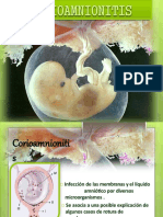 Corioamnionitis