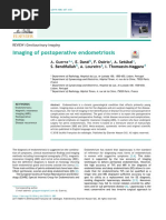 Imaging of Postoperative Endometrios - 2019 - Diagnostic and Interventional Imag