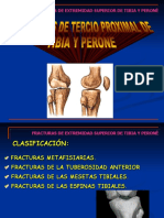 FRACTURA DE Tibia Proximal