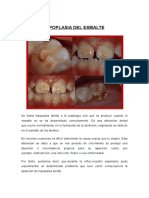 Patologias Del Esmalte y Pulpa Dental