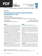 rpt.3202.fs1807009 Osteocondroma en Tuberculo Lateral