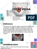 Cancer de Vejiga