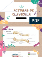 Fractura de Clavicula