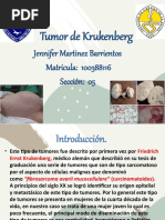 Tumor de Krukenberg 