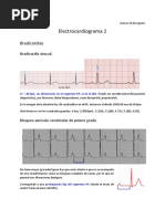 Electrocardiograma 2