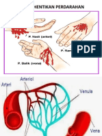 2 Teknik Hentikan Perdarahan