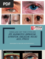 Infection of Eyelids