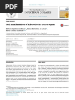 (G1.4) 4. - Tuberculosis Caso Vyv