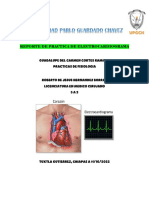 Reporte Practica de Electrocardiograma 3a2