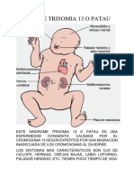 Sindrome Trisomia 13 o Patau