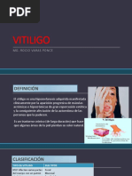 Vitiligo