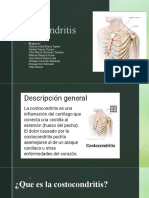 Costocondritis