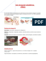 Parálisis Braquial Obstétrica (PBO) : Factores de Riesgo